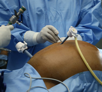 Surgical Gastroenterology    